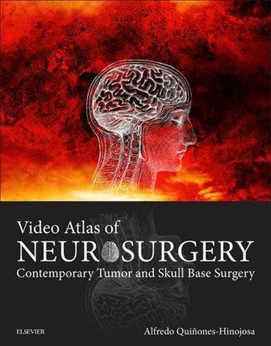 Video Atlas of Neurosurgery E-Book - cover