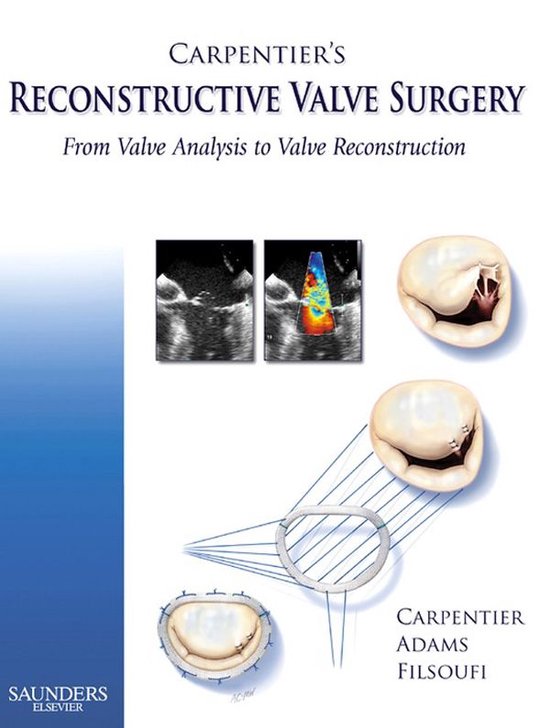 Carpentier'S Reconstructive Valve Surgery E-Book - cover