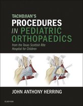 Tachdjian's Procedures in Pediatric Orthopaedics