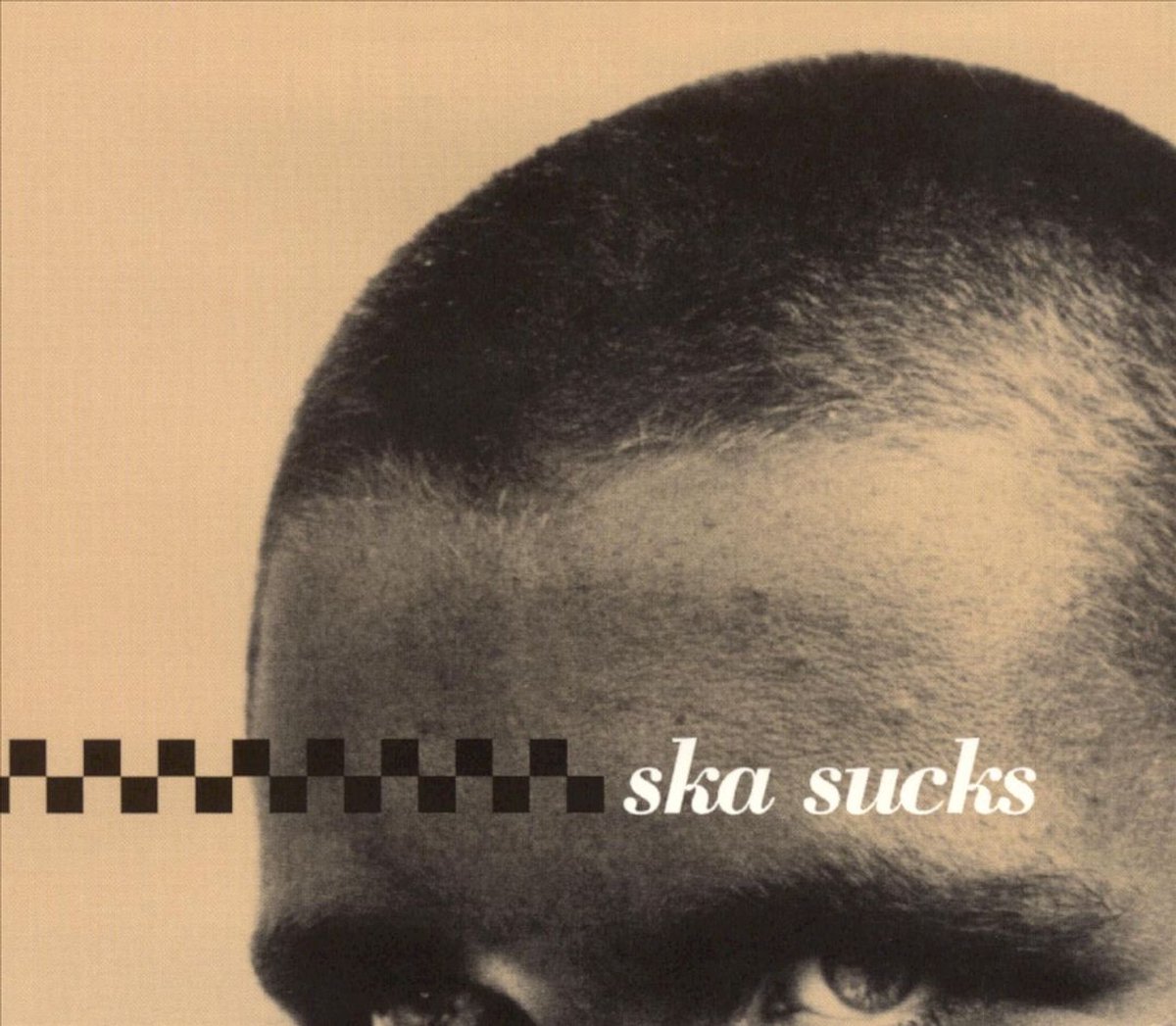 Ska Sucks