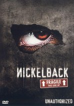 Nickelback - Unauthorized Fragile