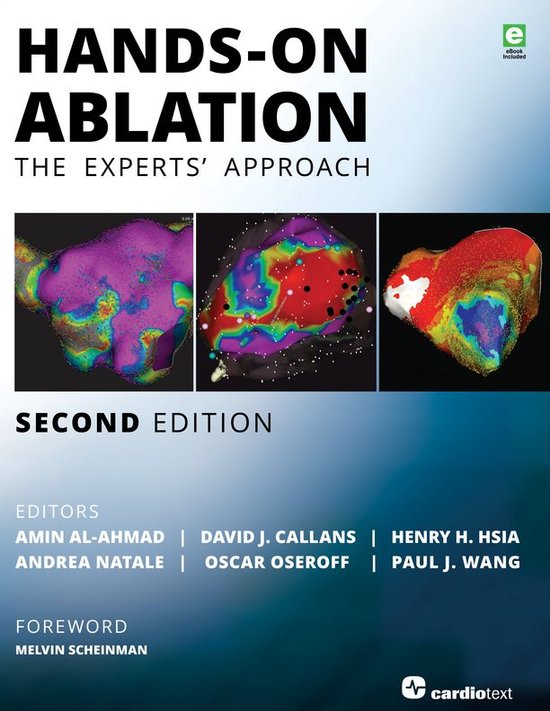 Foto: Hands on ablation