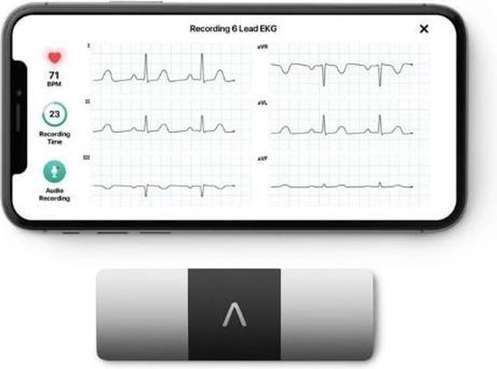 Kardia Mobile 6-kanaals ECG monitor