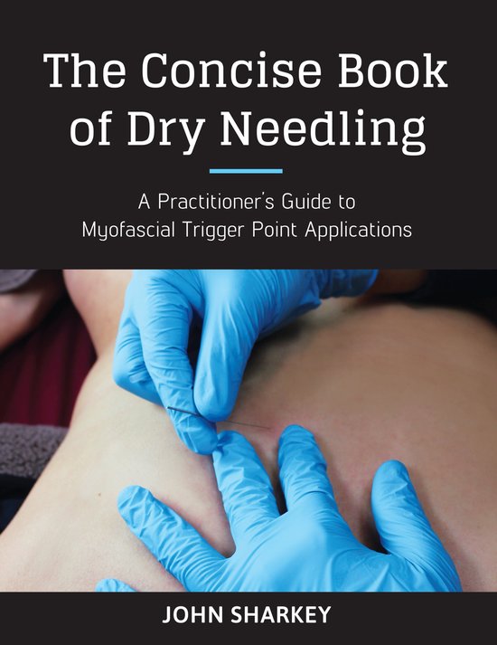 Foto: The concise book of dry needling