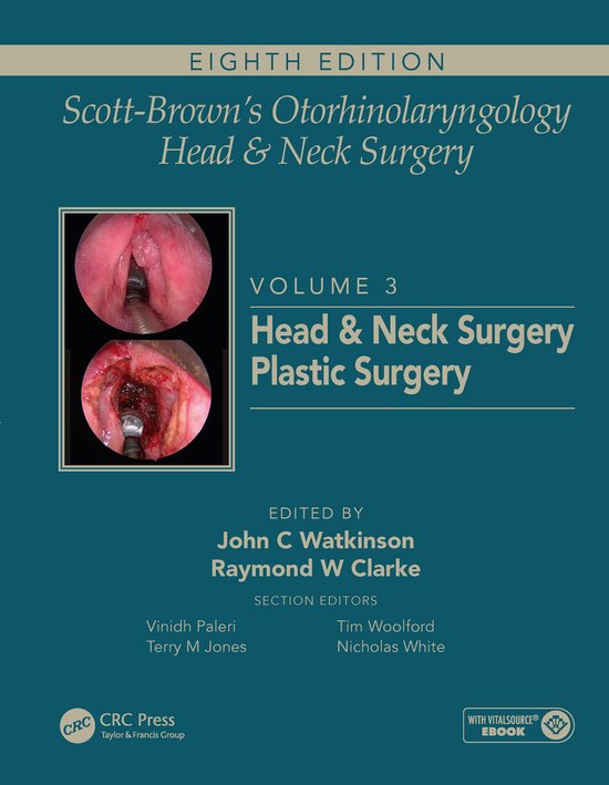 Scott-Brown's Otorhinolaryngology and Head and Neck Surgery - cover