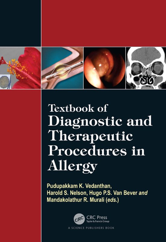Textbook of Diagnostic and Therapeutic Procedures in Allergy ...