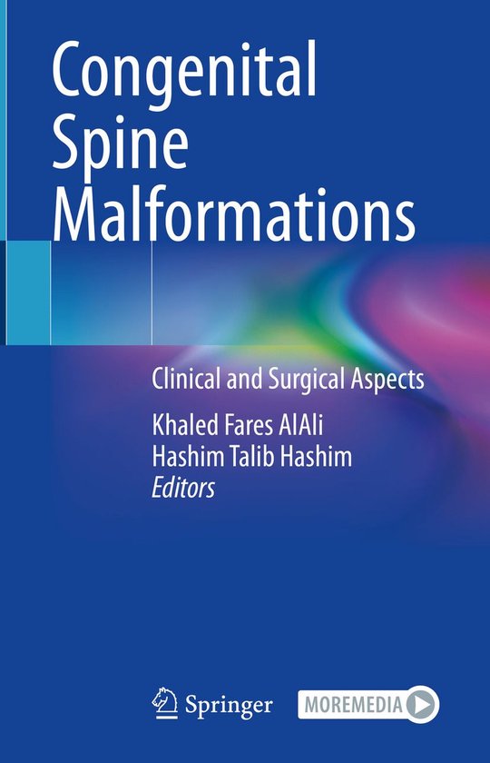 Medicine (R0) - Congenital Spine Malformations - cover