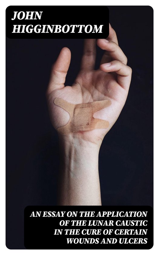 An Essay on the Application of the Lunar Caustic in the Cure ... - cover