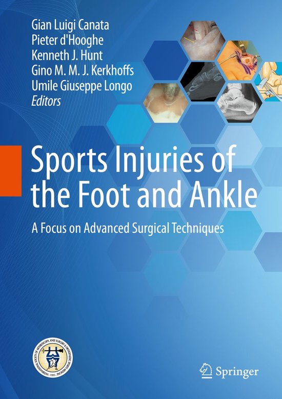 Medicine (R0) - Sports Injuries of the Foot and Ankle - cover