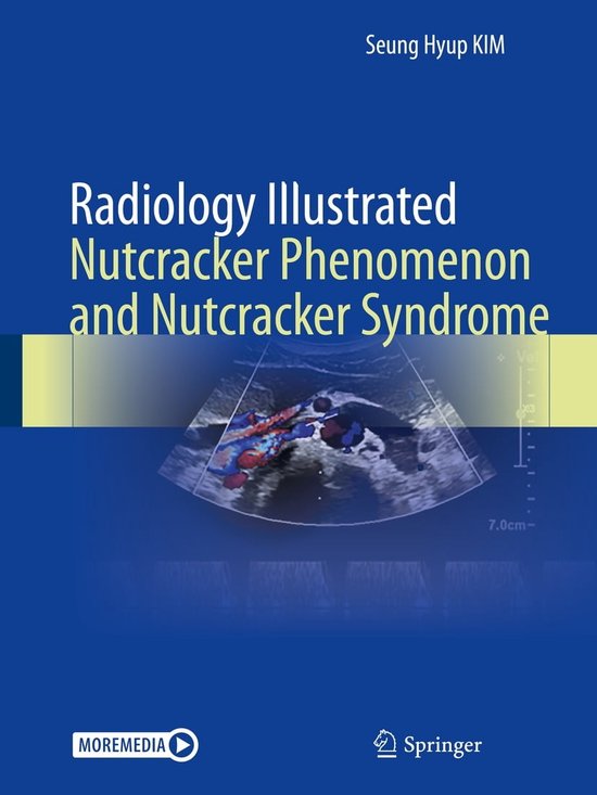 Radiology Illustrated Radiology Illustrated Nutcracker Phenomenon