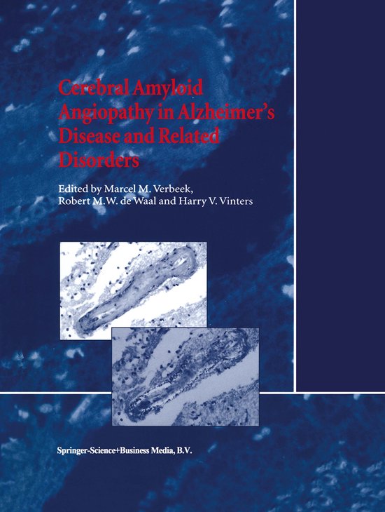 Cerebral Amyloid Angiopathy in Alzheimer’s Disease and Rel ... - cover