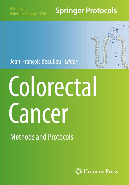 Methods in Molecular Biology- Colorectal Cancer | 9781493992782 ...