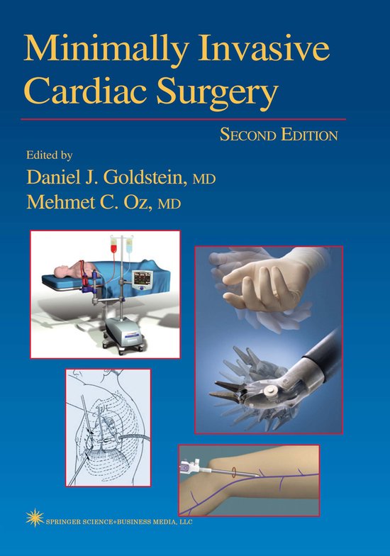 Minimally Invasive Cardiac Surgery | 9781617374005 | Boeken | bol