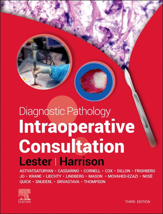 Foto: Diagnostic pathology diagnostic pathology intraoperative consultation