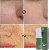 Peel & Prep gezichtsmasker om dode cellen te verwijderen en poriën te verkleinen-Pore minimizer facemask- remove dead cells mask