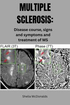 Multiple sclerosis