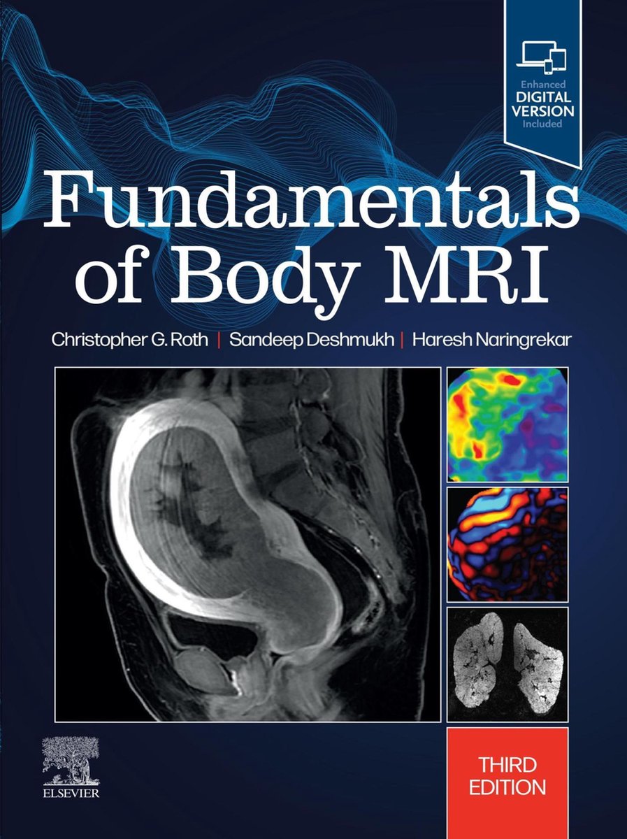 Omslag van Fundamentals of Radiology - Fundamentals of Body MRI E-Book