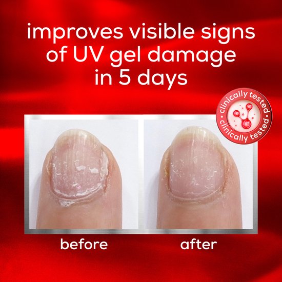Vergelijking voor en na de Essie nagelbehandeling. Verbetert zichtbare schade van UV-gel in 5 dagen.
