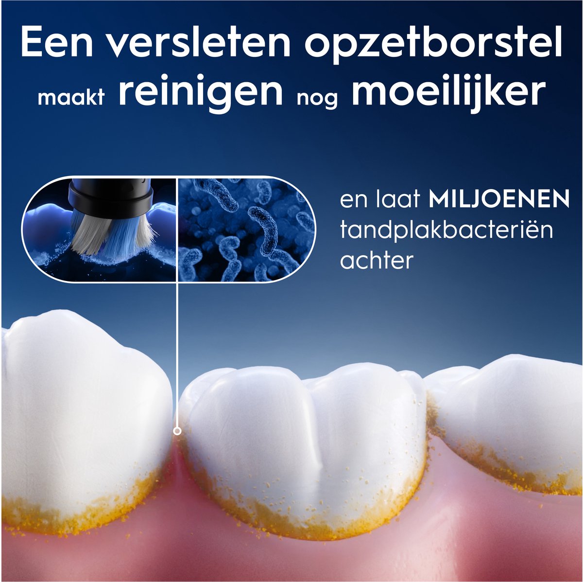 Oral-B iO Opzetborstels - Ultimate Clean - Wit - 4 Stuks thumbnail 6