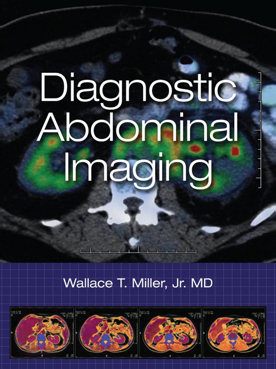 Livre: 'Diagnostic Abdominal Imaging' avec une image d'une tomodensitométrie abdominale montrant les reins en couleur.