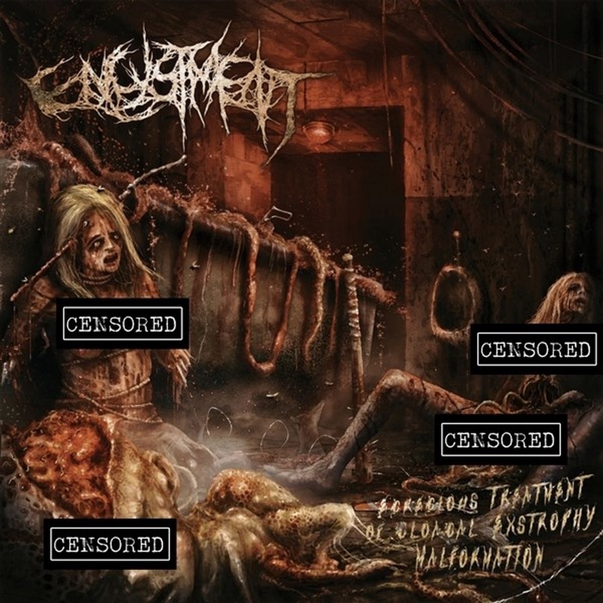 Encystment - Egregious Treatment of Cloacal Extrophy Malformation (CD)