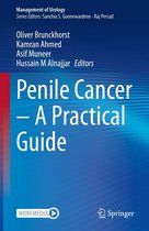 Management of Urology - Penile Cancer – A Practical Guide