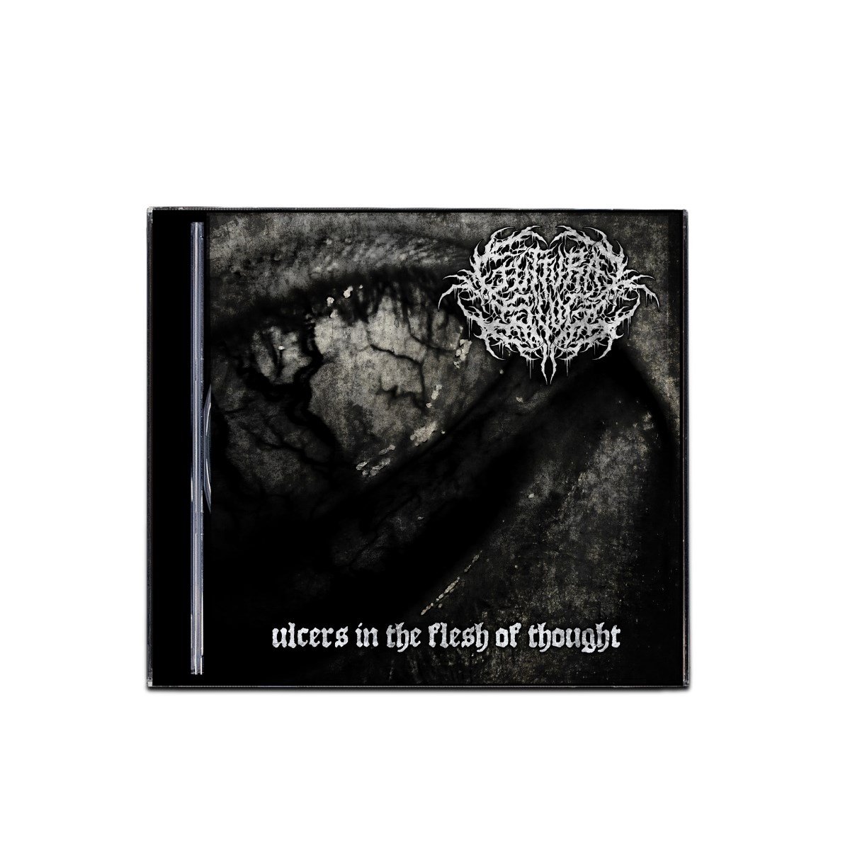 Ulcers in the Flesh of Thought