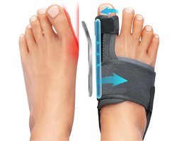 Hallux Valgus Grote Teencorrector - Set van 2 - Verstelbare Teenspreider met Spalk - Bunion Corrector - Teen Brace - Toe Spreader - Links en Rechts - One Size