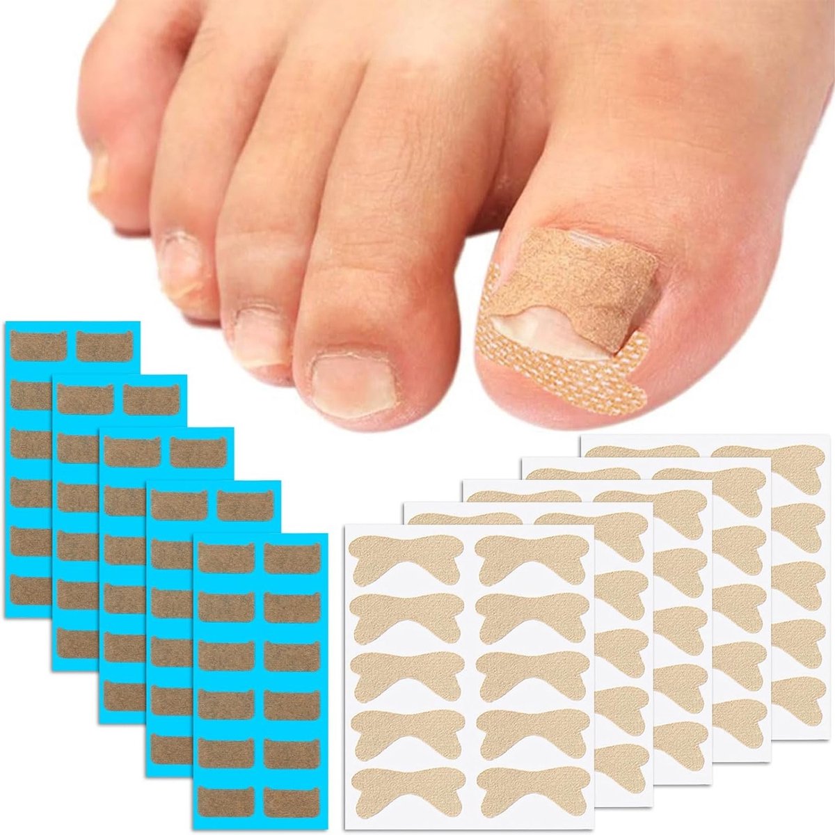 Ingrown Toenail Correctie Set met 60 Zelfklevende Nagelpatches en 50 Scheidingsstickers voor Voetverzorging en Comfort