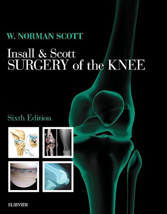 Insall & Scott Surgery of the Knee E-Book - cover