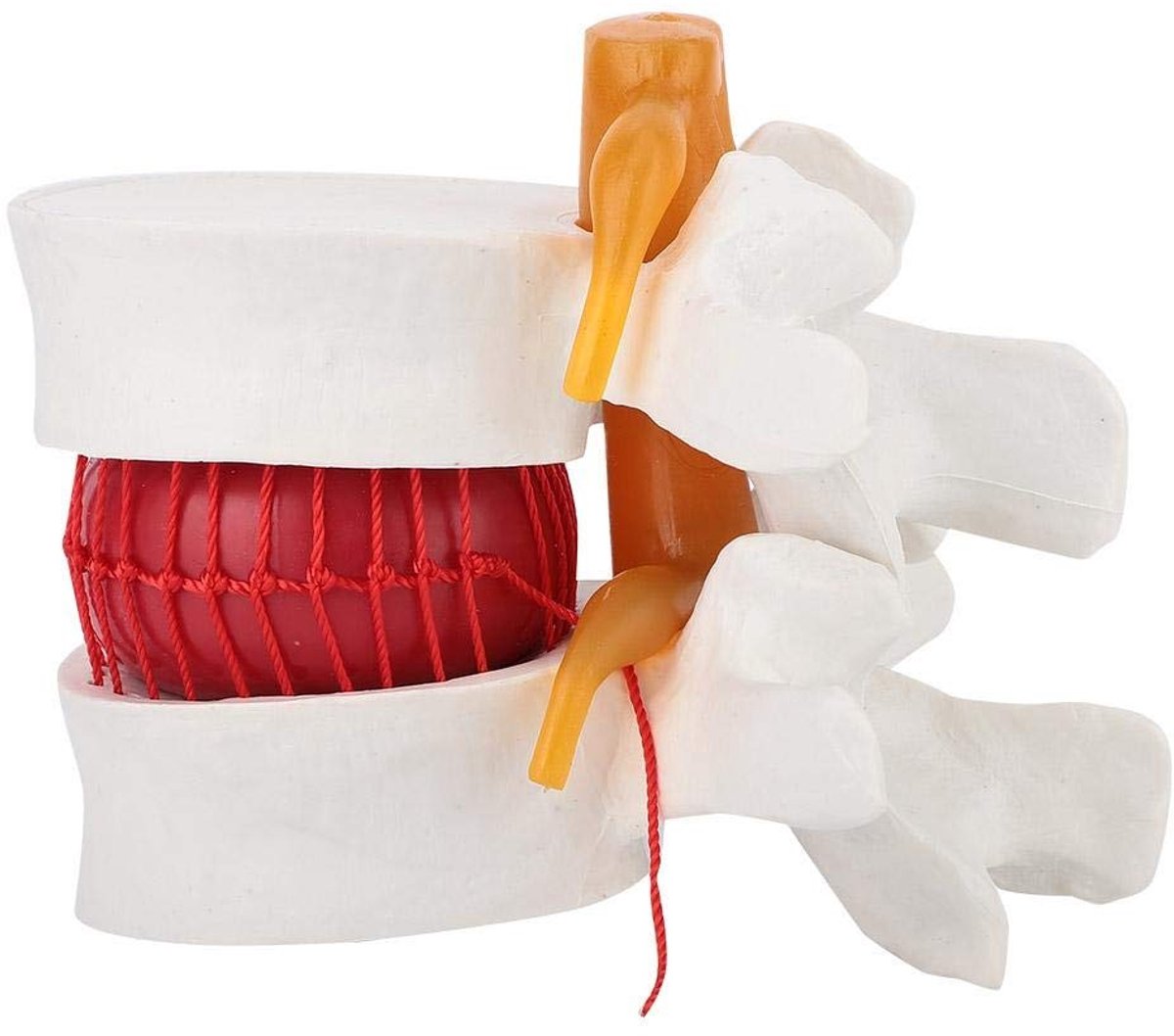 MTTproducts- Lumbale Hernia Model 1:1 - Anatomisch Model - Wervelkolom Demonstratie - Pedagogisch Hulpmiddel - Onderwijs - Kwalitatief Hoogwaardig