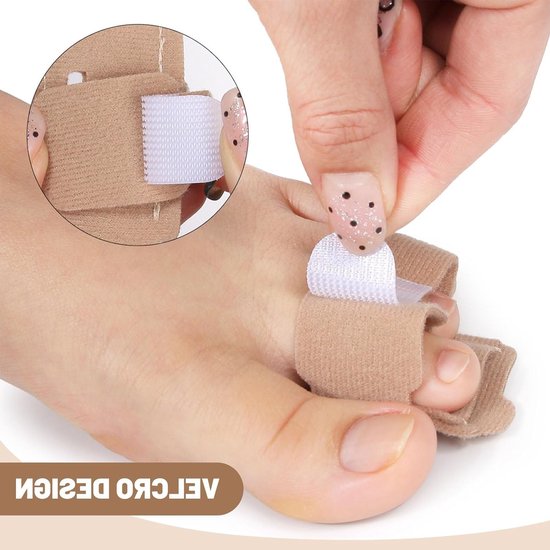 Corrector voor Hamertenen en Tussenruimte, Verstelbare Spalken en Bescherming voor Overlappende Tenen, Hallux Valgus Oplossing voor Dames en Heren, Comfort en Ondersteuning — afbeelding 2