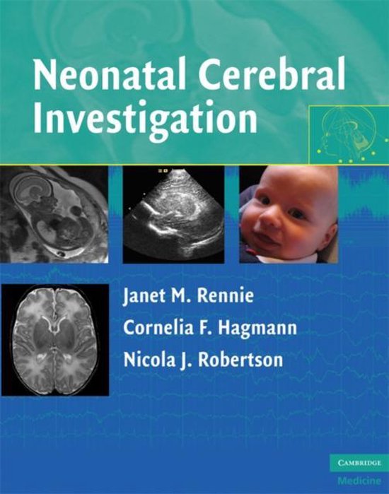 Mary Rutherford Neonatal Cerebral Investigation | 9780521838481 | Mary Rutherford ...