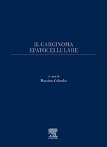 Il carcinoma epatocellulare