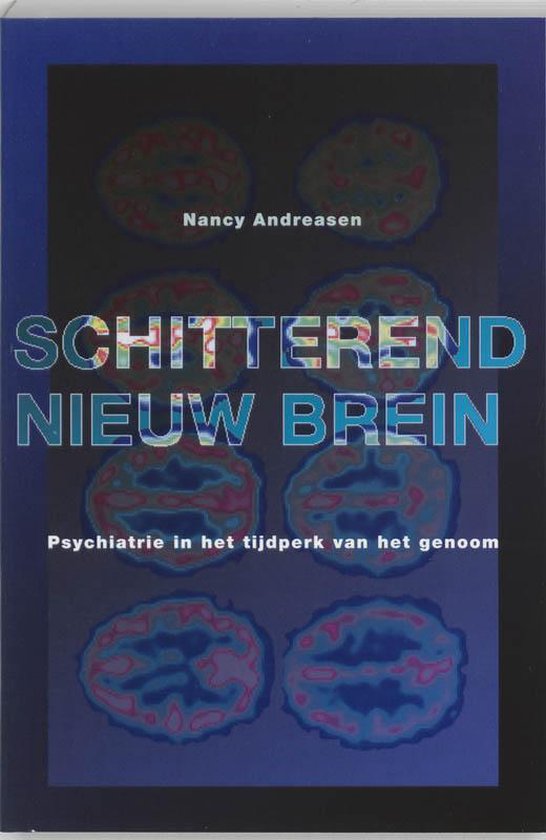 Cover van het boek 'Schitterend nieuw brein / druk 1'