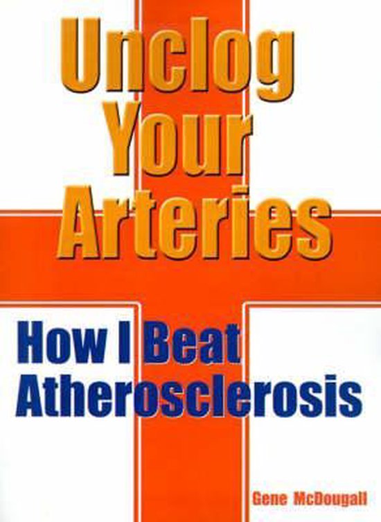 Unclog Your Arteries, Gene Mcdougall 9780759622791 Boeken bol