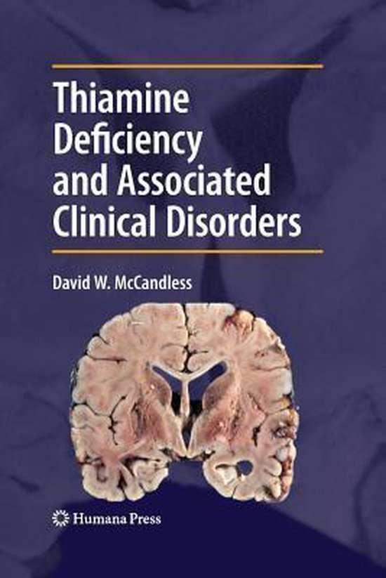 Thiamine Deficiency and Associated Clinical Disorders - cover