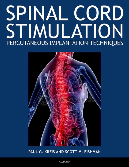 Spinal Cord Stimulation - cover