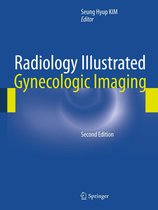 Radiology Illustrated - Radiology Illustrated: Gynecologic Imaging