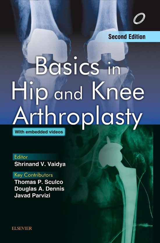 Basics in Hip and Knee Arthroplasty - E-book - cover