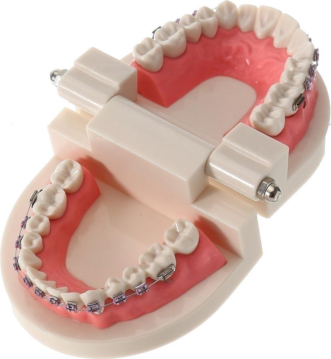 Tandheelkundige tanden malocclusie orthodontische model met volledige metalen beugels... |