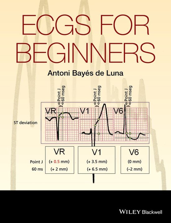 ECGs for Beginners - cover