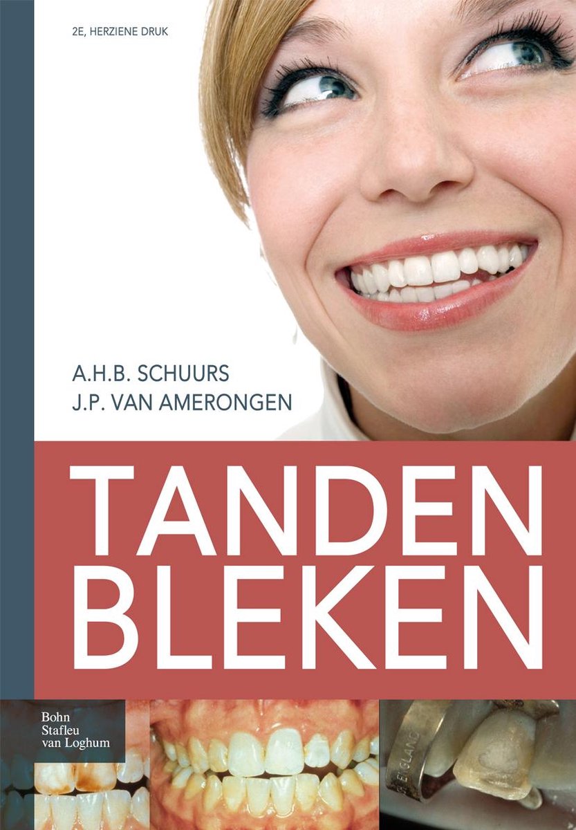zelfmoord detectie fluweel Tanden bleken (ebook), A H B Schuurs | 9789031363216 | Boeken | bol.com