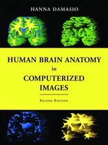 Human Brain Anatomy In Computerized Images
