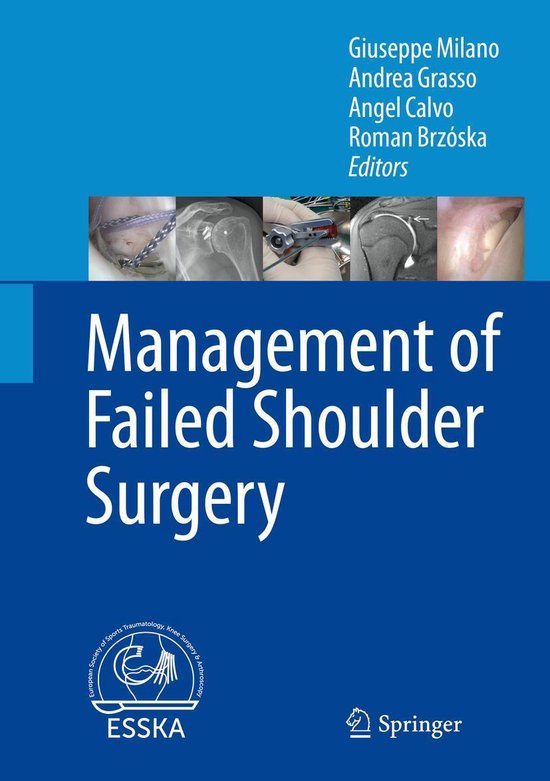 Medicine (R0) - Management of Failed Shoulder Surgery - cover