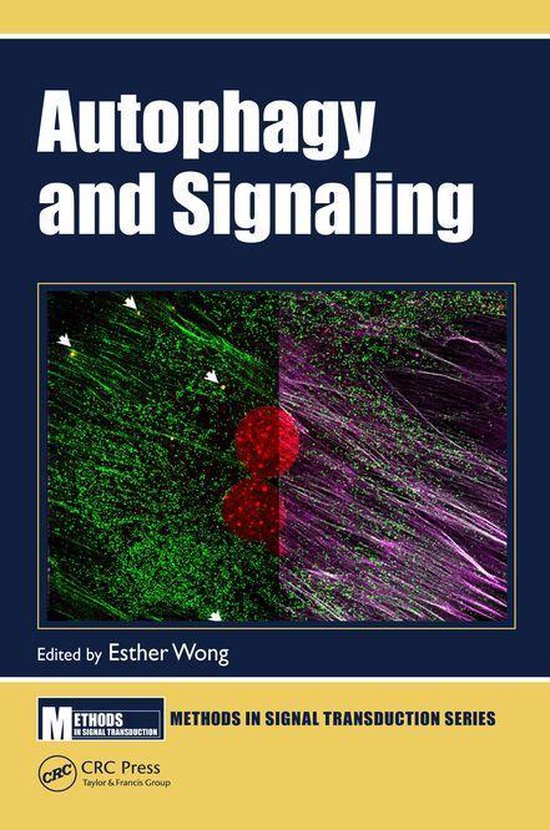 Autophagy and Signaling (ebook) | 9781351646970 | Boeken | bol.com