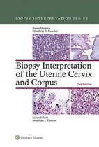 Biopsy Interpretation Series - Biopsy Interpretation of the Uterine Cervix and Corpus