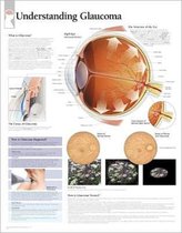 Understanding Glaucoma Laminated Poster