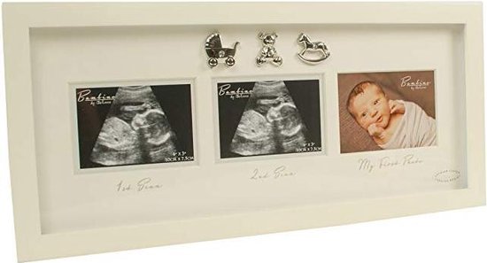 cadre photo échographie bébé