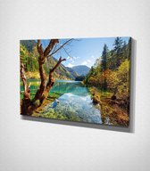 Autumn Canvas - 100 x 70 cm